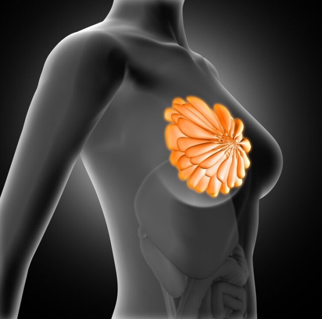 Breast Augmentataion