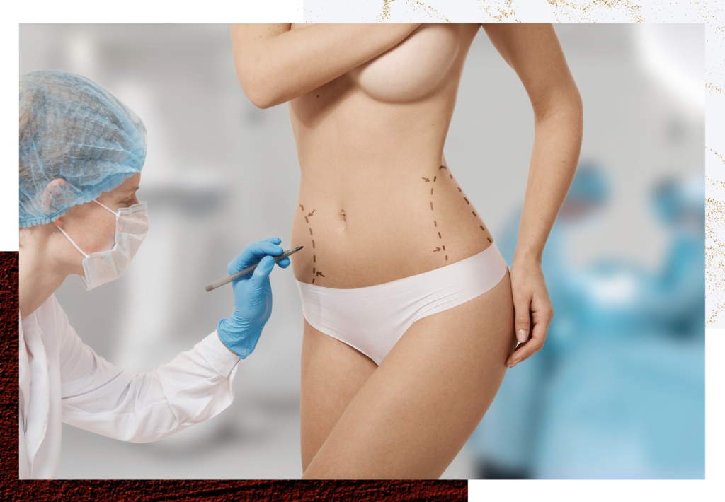 Fat Grafting Services in Dubai​