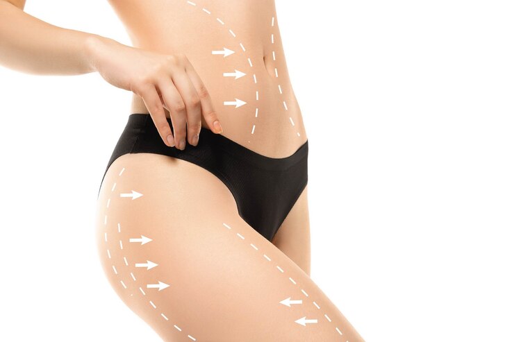 Liposuction & Body Contouring