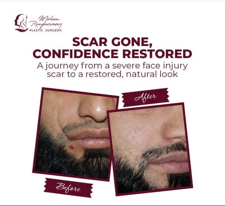 Scars surgery in dubai