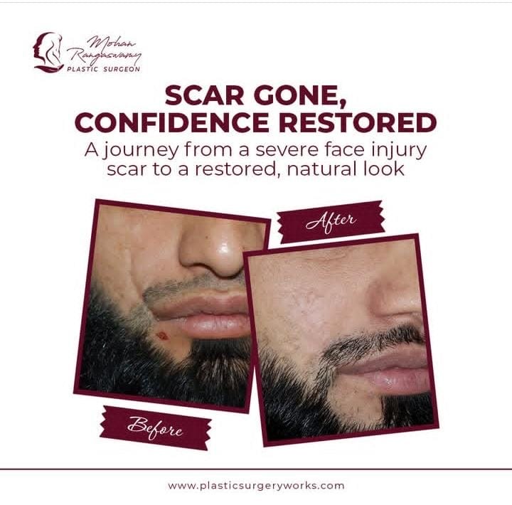 Scars surgery in dubai