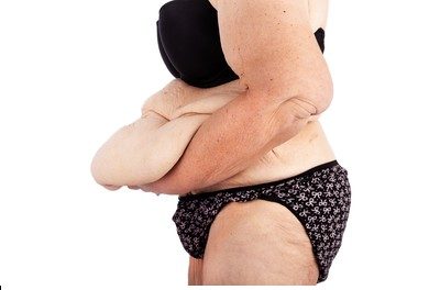 best post weight loss surgery in Dubai