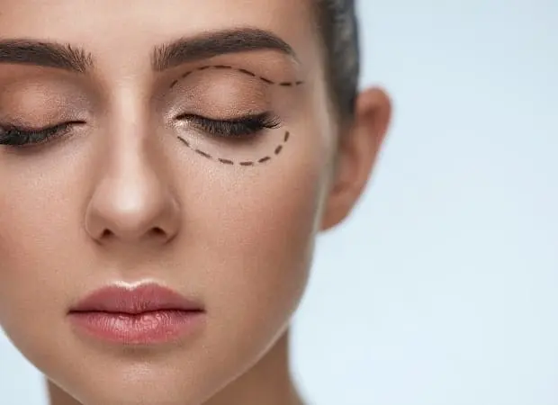 lower-eyelid-surgery