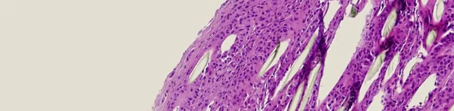 tissue-elasticity-in-plastic-surgery