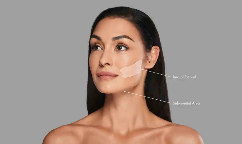 Ideal-Candidates-For-Buccal-Fat-Removal