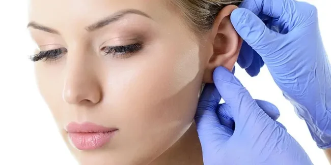 otoplasty-in-surgery