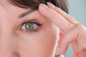 drooping-eyelids-surgery