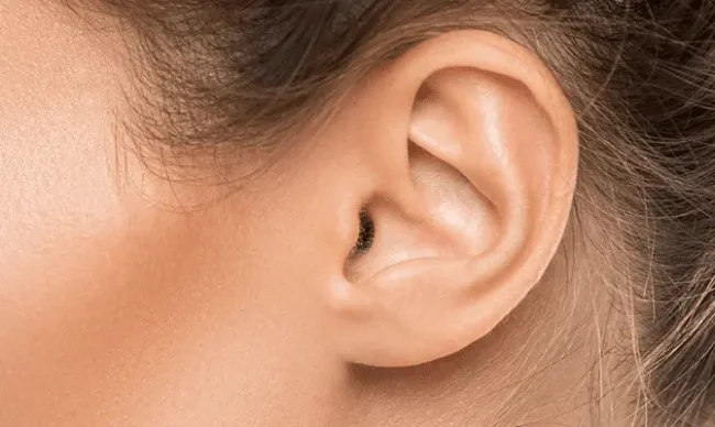 earlobe-repair