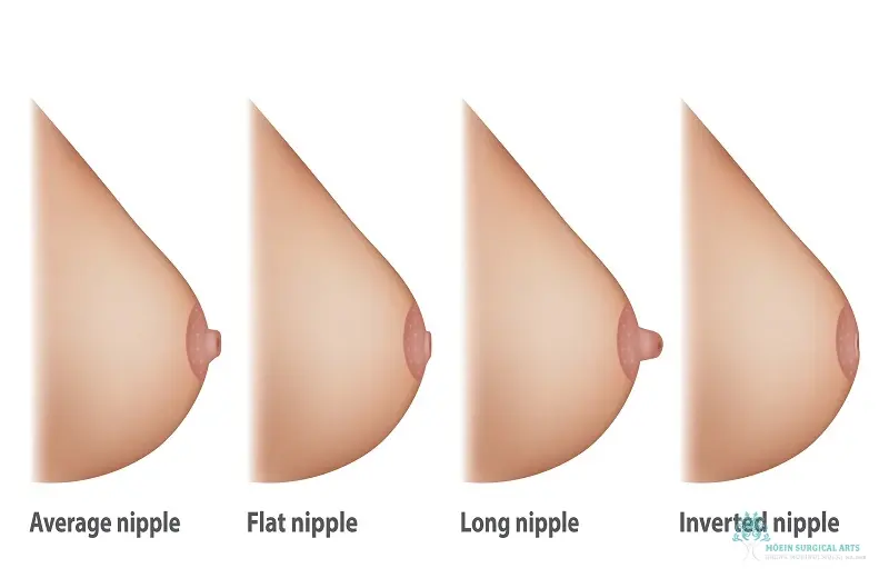 what-are-inverted-nipples