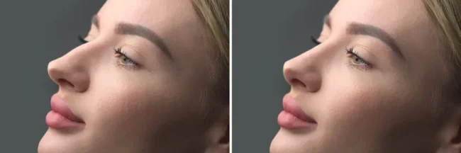 crooked-nose crooked-nose