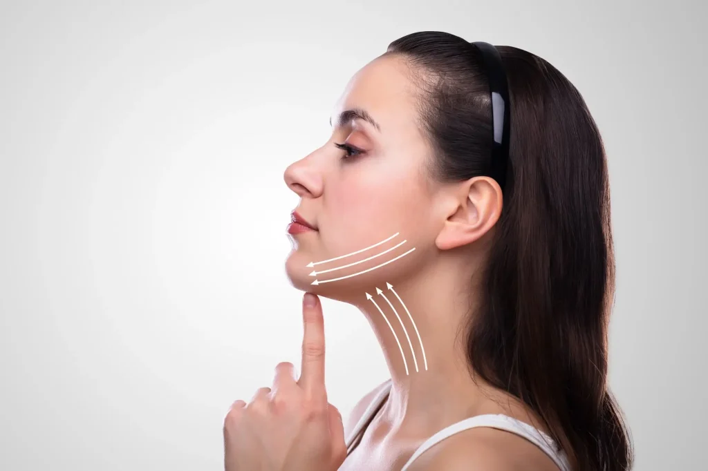 neck-fat-removal